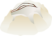 Illustration of a closed barnacle